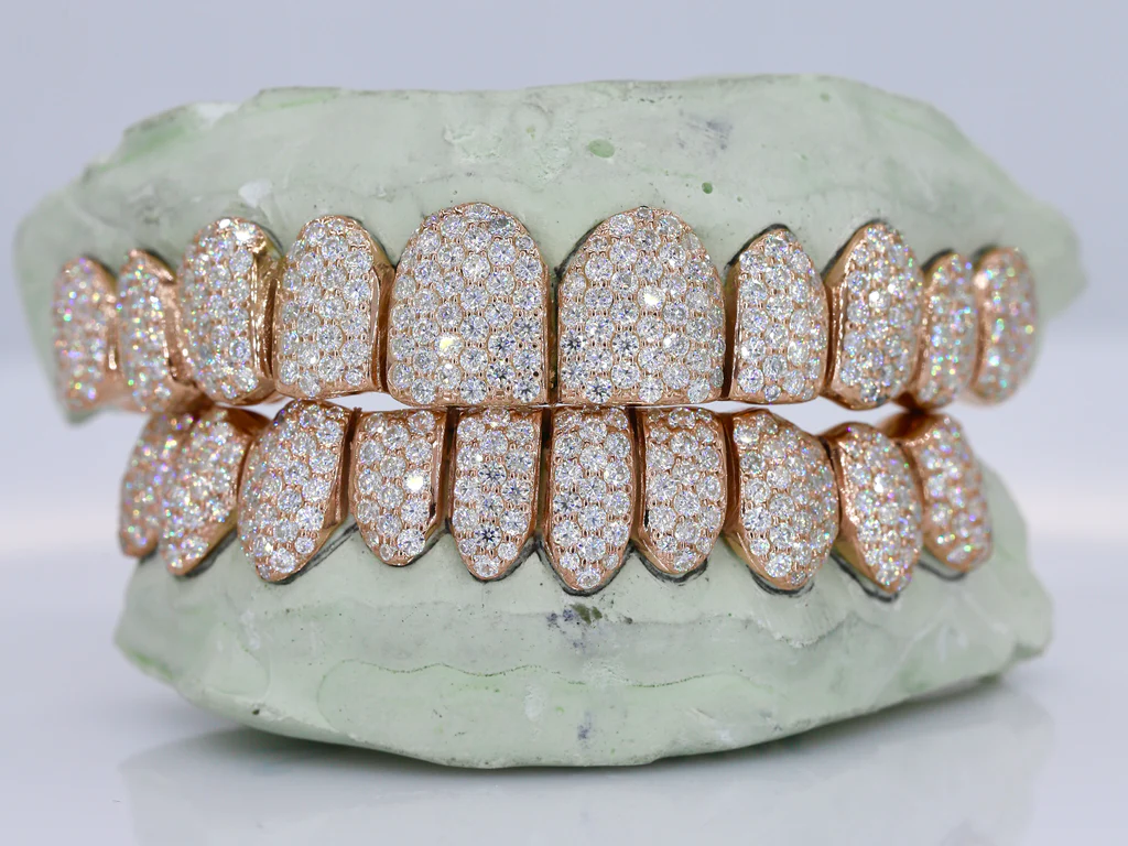 Moissanite Grillz