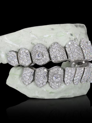 925 Sterling silver moissanite dental 8 custom teeth grillz for men women hot selling fashionable hip hop jewelry wholesale