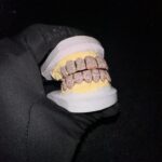 Custom fashion wholesale Top 8 bottom 8 tooth grillz for women in vvs clarity designer jewlery 14 kt moissanite diamonds