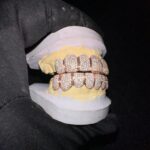 Custom fashion wholesale Top 8 bottom 8 tooth grillz for women in vvs clarity designer jewlery 14 kt moissanite diamonds