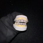 Custom Hip Hop Jewelry Teeth Down 10 925 Sterling Silver VVS Clarity Round Cut Diamond Fully Iced Out Moissanite Grillz