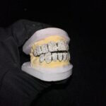 Custom Hip Hop Jewelry Teeth Down 10 925 Sterling Silver VVS Clarity Round Cut Diamond Fully Iced Out Moissanite Grillz